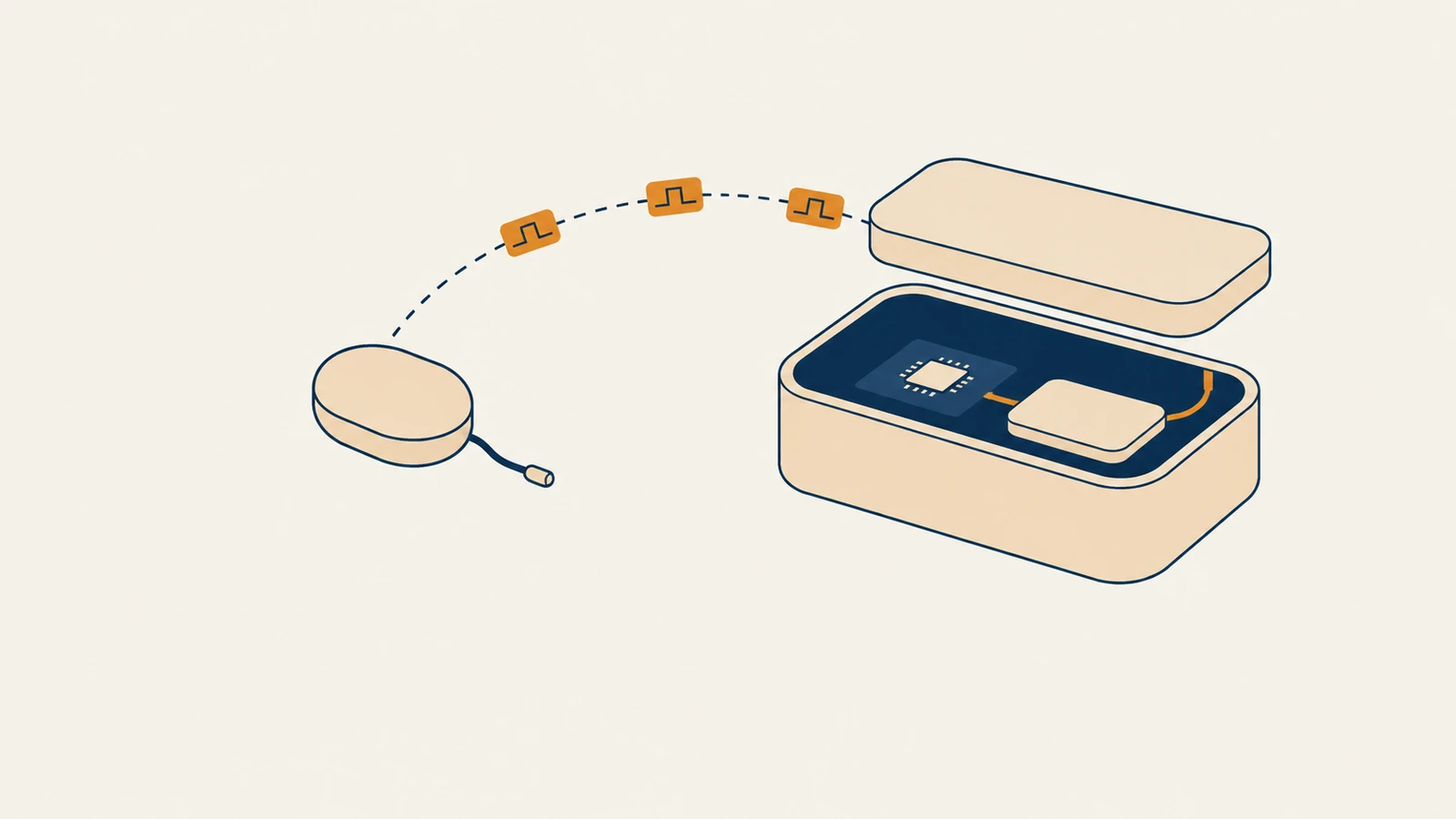 Flat isometric illustration of a small sealed implant capsule with a short lead and a larger open wearable hub showing a circuit board, a chip and a battery, linked by a dashed arc carrying three small waveform tiles