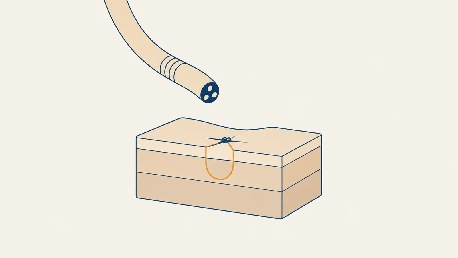 Flat isometric illustration of a flexible endoscope tip approaching a layered block of tissue, where a single suture shown on the cut face passes through the top layer into the middle layer and is tied over a closed incision