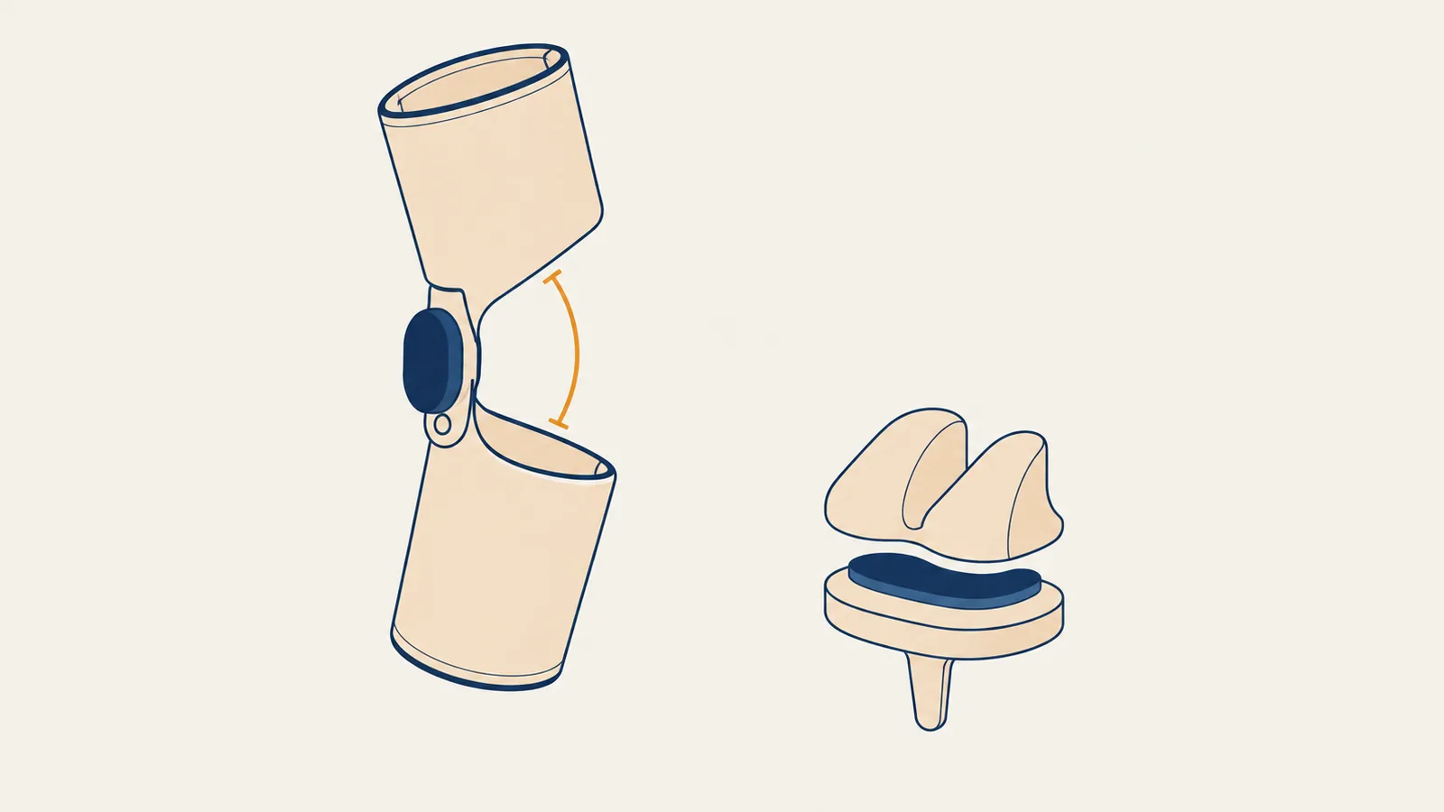 Flat isometric illustration of an empty hinged knee brace with two shells, a small sensor module on the hinge and an arc marking the flexion angle, next to a generic total knee implant with a dark pad between its two parts